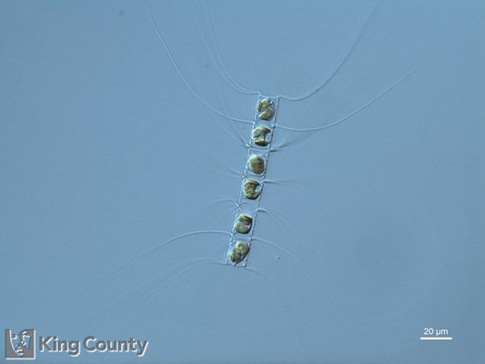Photo of Chaetoceros diadema